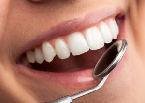 Scopri di più sull'articolo Odontoiatria estetica