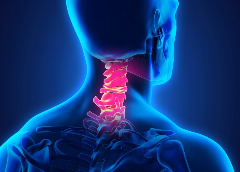 Scopri di più sull'articolo Una soluzione per la tua cervicale: il sistema superinduttivo (SIS)