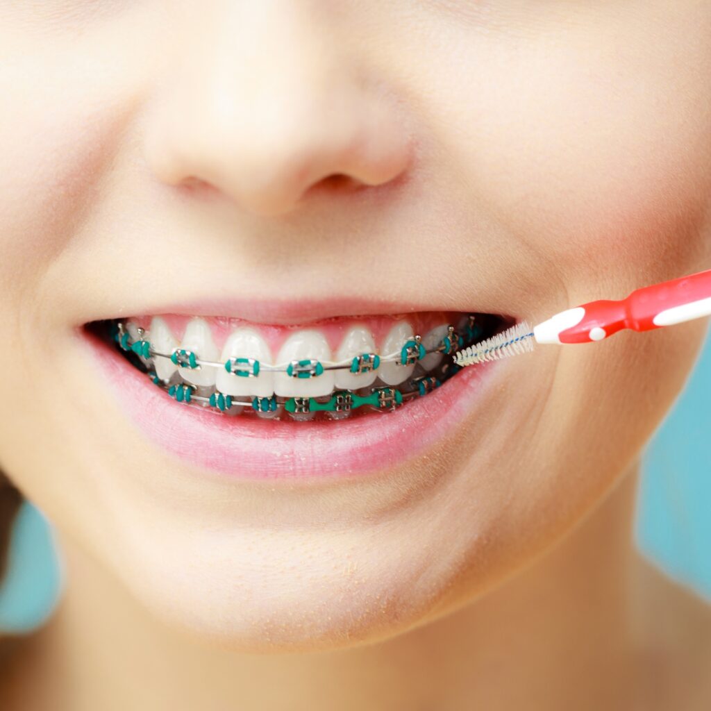 Igiene orale e apparecchio denti bambini - F-Medical Group