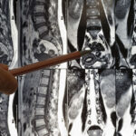 Esame diagnostico per il mal di schiena