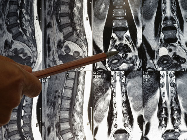 Al momento stai visualizzando Esame diagnostico per il mal di schiena