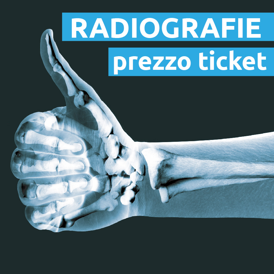 Radiografia o Rx al Prezzo Tiket €25 nel F-Medical Group Frosinone
