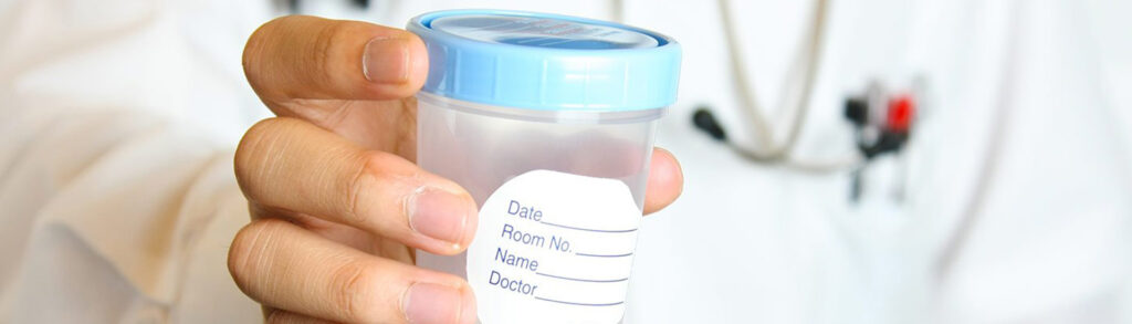 urinocultura - medical group italia