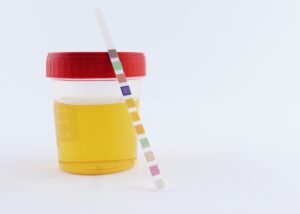 Scopri di più sull'articolo Cos’è l’urinocoltura?