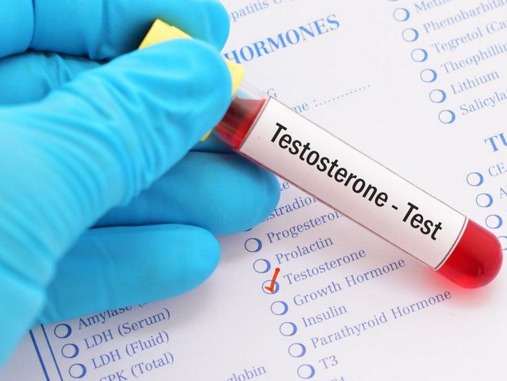 analisi testosterone - medical group italia