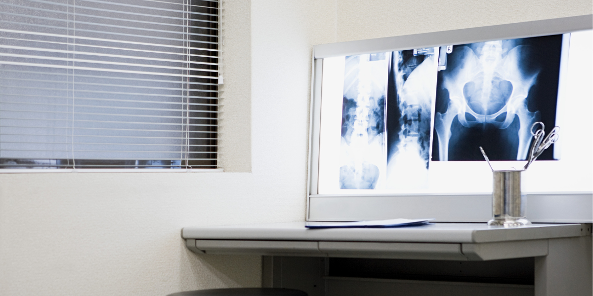 RX Bacino Sotto Carico nel F-Medical Group di Frosinone