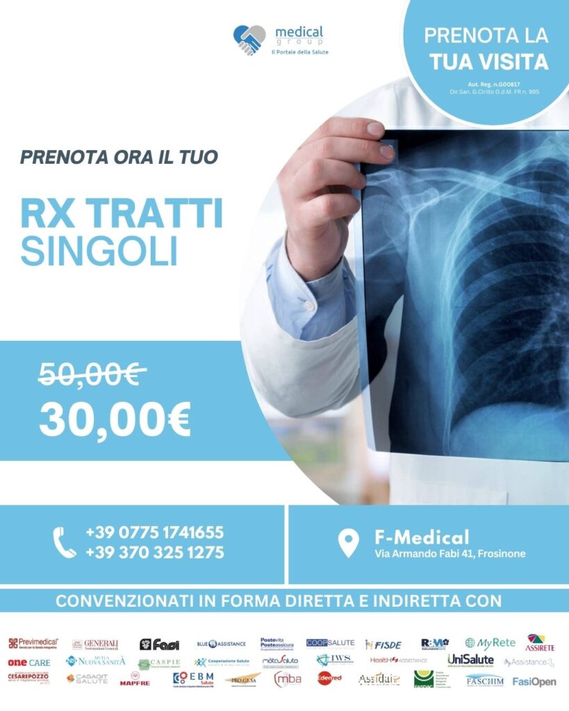 Tariffe del Mese Radiologia F-Medical Frosinone RX Tratti singoli 30 euro