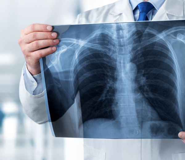 RADIOGRAFIA O RX F-Medical Group Frosinone - Formato Mobile