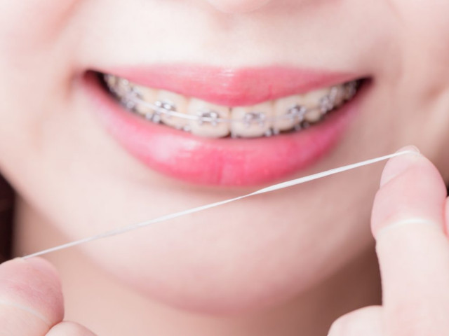 apparecchio denti