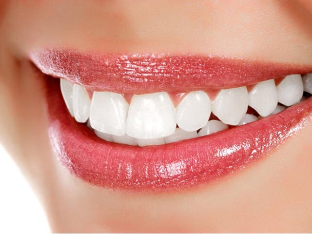 apparecchio denti