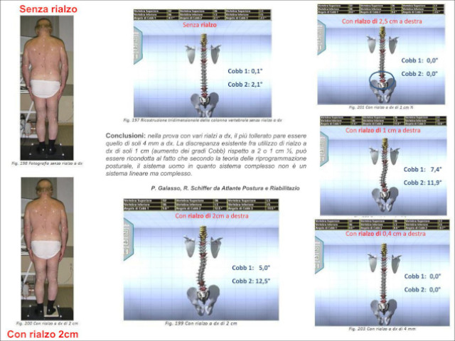 benefici 3d bak