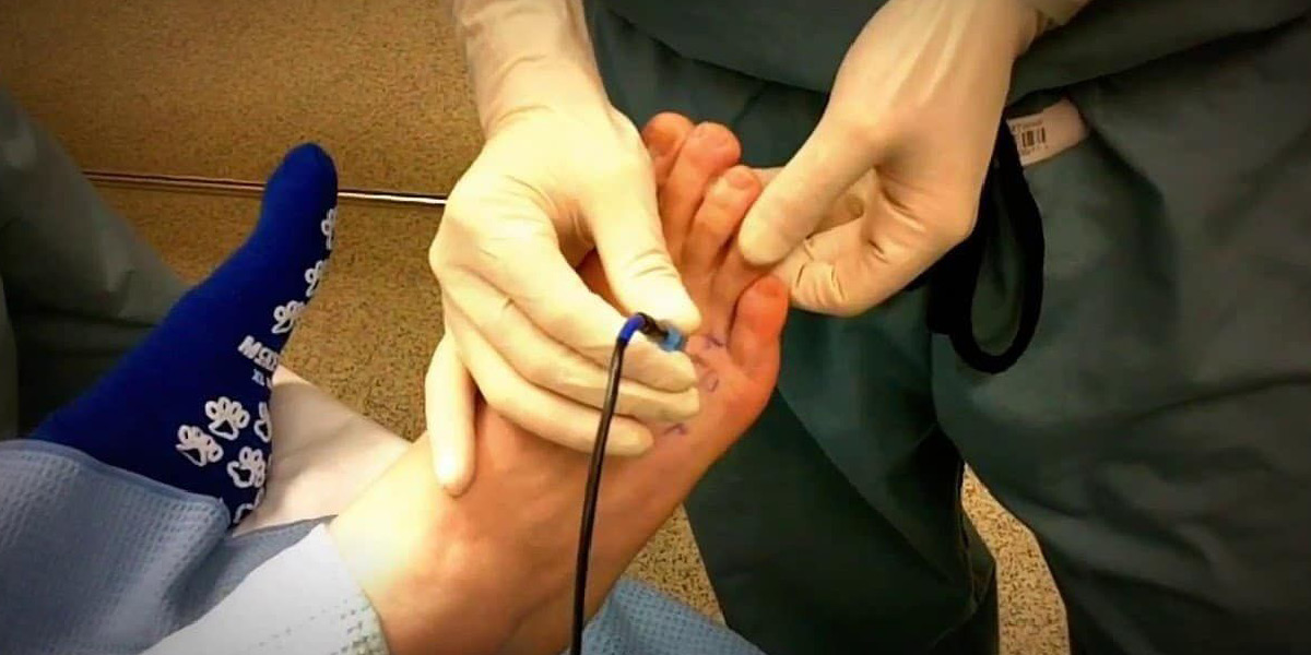 diagnosi differenziale neuroma di morton medical group