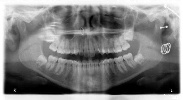 panoramica dente del giudizio