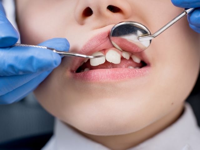 perche rivolgersi al dentista