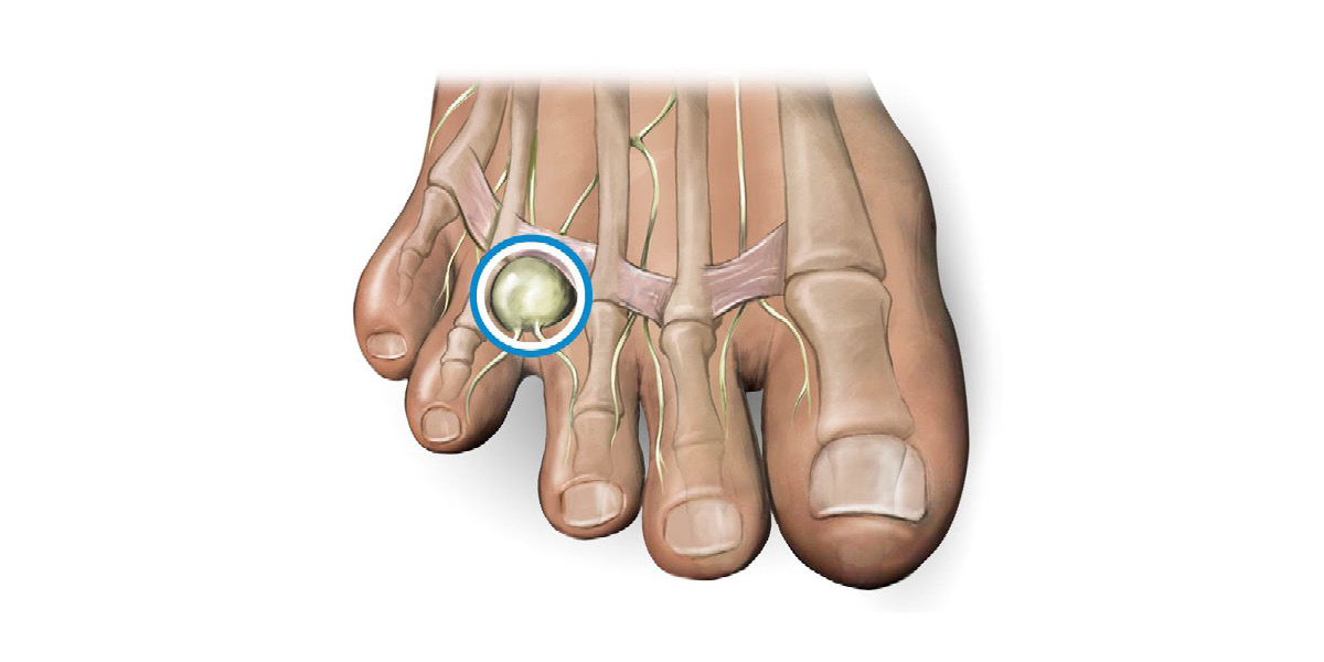 piede doloroso medical group