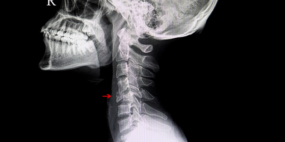 quando non effettuare il massaggio cervicale medical group