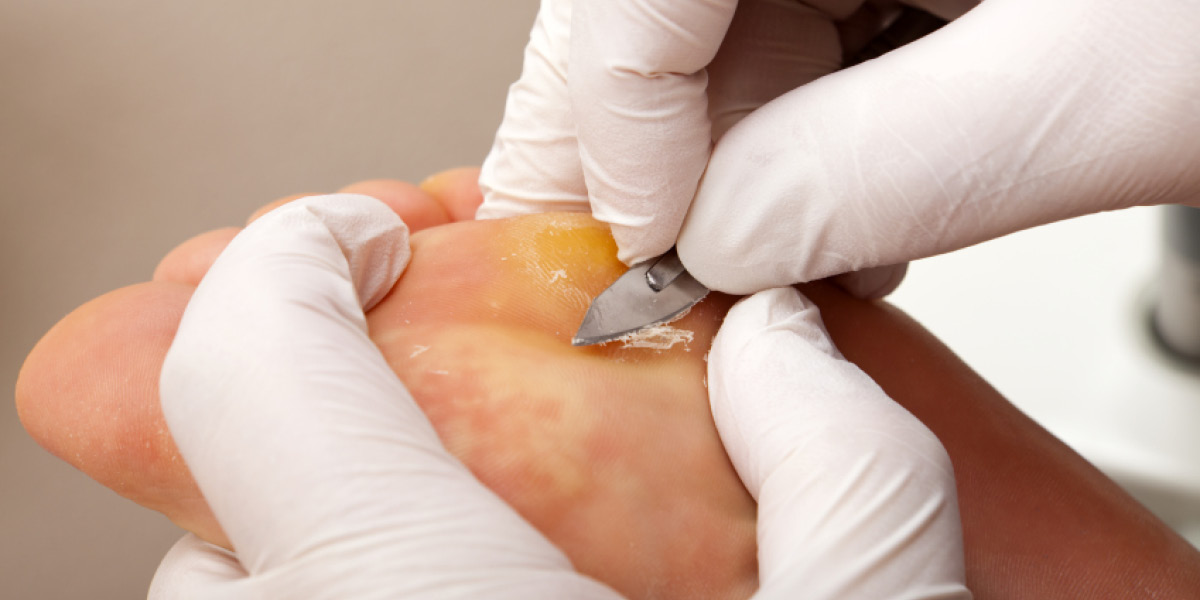 terapia metatarsalgia medical group
