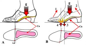 terapia ortesica
